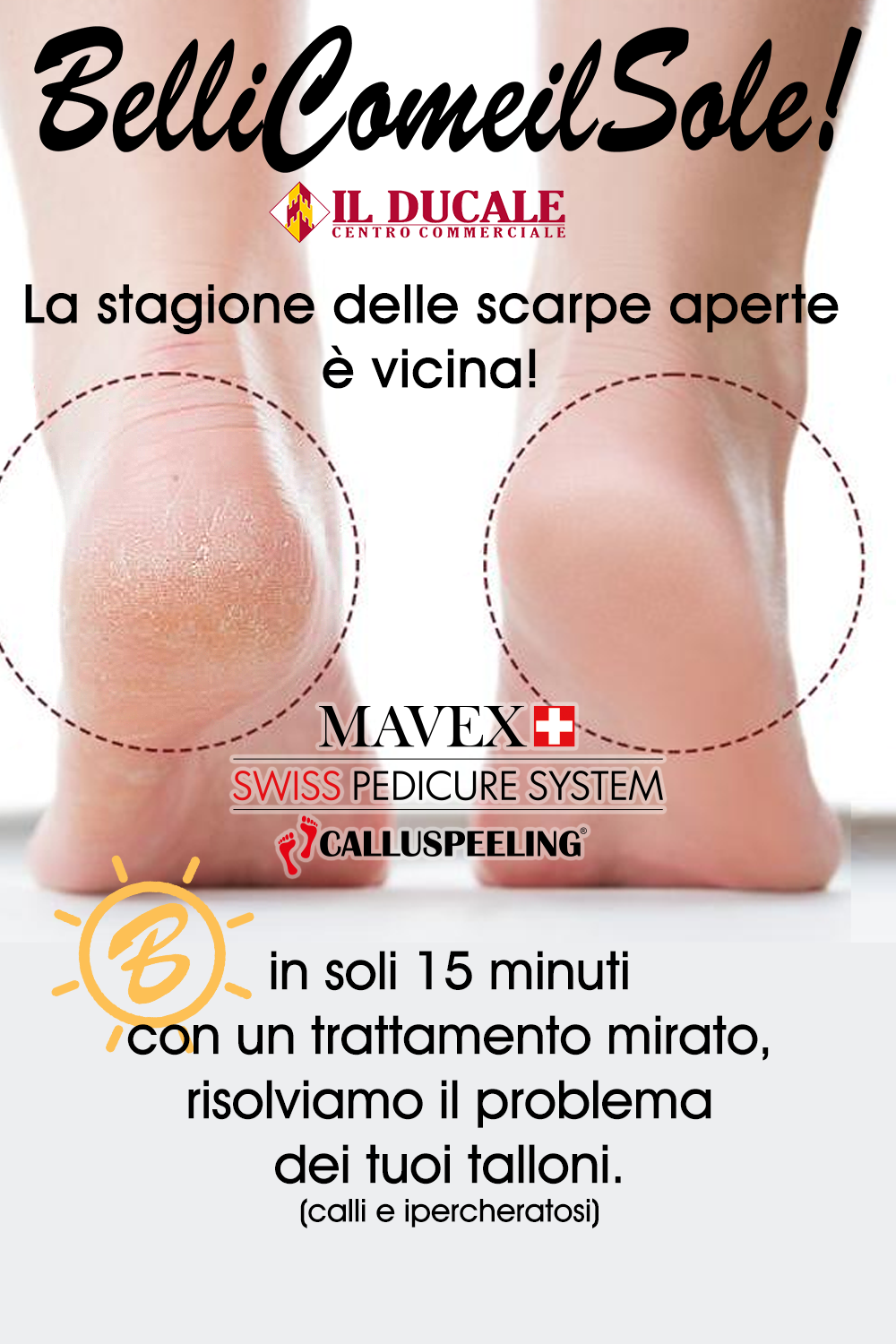 BelliComeilSole trattamento Talloni con Callusped